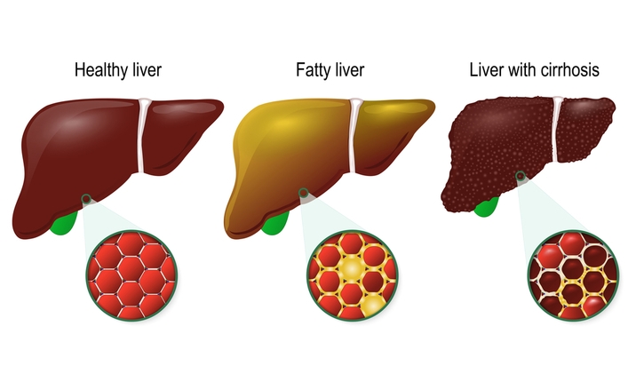 Reasons Beer Is Not Bad For You